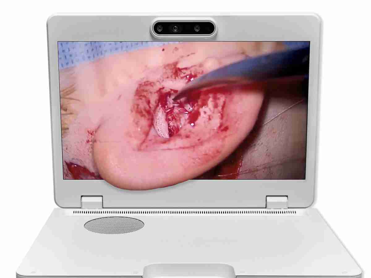 达擎之＂Heads-up 3D显微手术显示系统＂，，整合4K裸眼3D显示及眼球追踪系统，，具备快速追踪人眼移动位置功能，，，减轻医师长时间维持固定姿势的负担，，，让医师能有更宽广清晰的3D立体视野及更舒适的姿势来执行手术。。